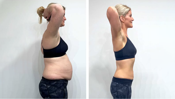 The Big Weight Loss Lie: Why You Don't Lose Weight Despite Dieting